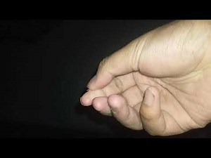 Aggressive Scab Scalp Scratching Part ✌️