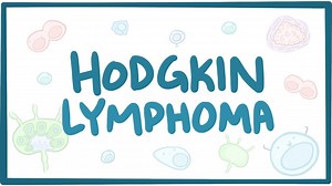Hodgkin lymphoma: Video, Causes, & Meaning | Osmosis