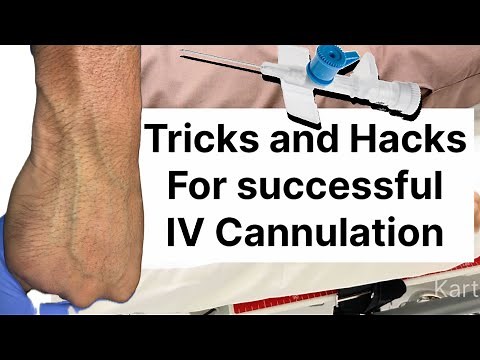 IV Cannulation Made Simple: Tricks for Hard-to-Find Veins !