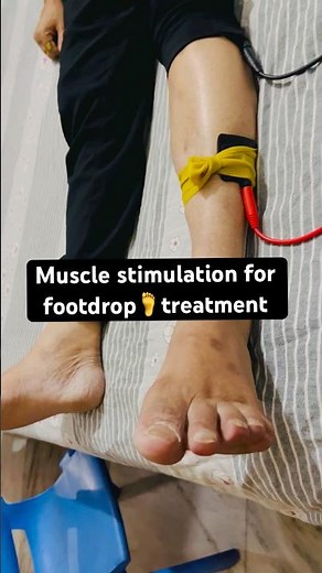 Muscle stimulation therapy for footdrop 🦶||#fourthphysio