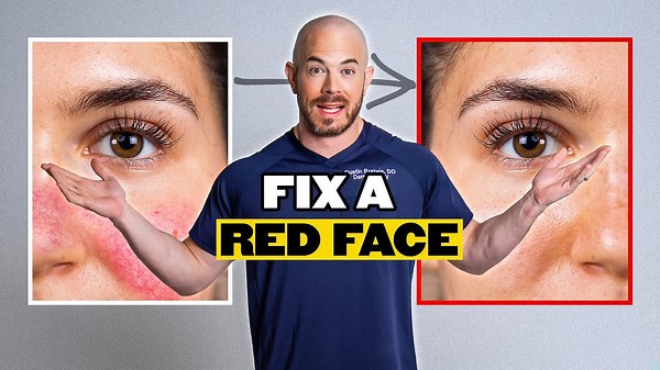 Top Dermatologist's Advice for Rosacea & Sensitive Skin