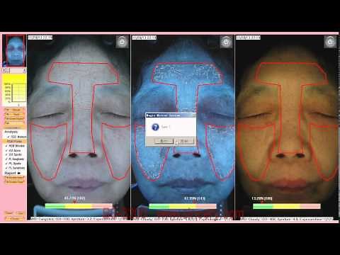 BS 3200 facial skin analyzer machine