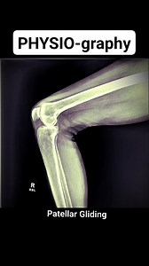 676K views · 6.3K reactions | Patellar Gliding in Knee Flexion and Extension | PHYSIO-graphy | Facebook