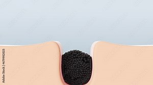 Dirt, bacteria and oil molecules enter the pore - clogged. 3D intro abstract skincare animation.