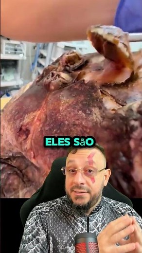 Cracas no casco da tartaruga sendo retiradas, vídeo satisfatório