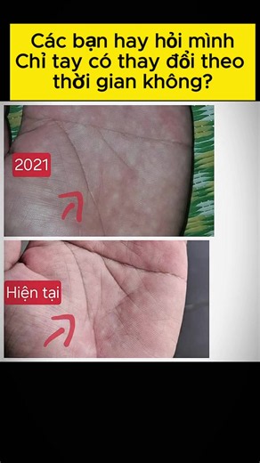 Chỉ tay trên lòng bàn tay không phải là một vệt mực cố định của số phận, mà nó liên tục biến chuyển theo từng suy nghĩ và hành động của chúng ta qua thời gian. Tướng do tâm sinh, vận mệnh nằm trong lòng bàn tay nhưng lại được quyết định bởi những gì bàn tay đó lựa chọn thực hiện. Khi ta đem lòng từ bi gieo hạt giống thiện lành, biết sẻ chia của cải, trao đi sức lực và nói lời tử tế, những năng lượng tích cực ấy sẽ dần tái cấu trúc tâm trí và để lại dấu vết rõ nét trên từng đường nét chỉ tay. Tíc