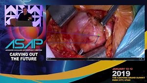 Subscapularis: Tenotomy and Repair