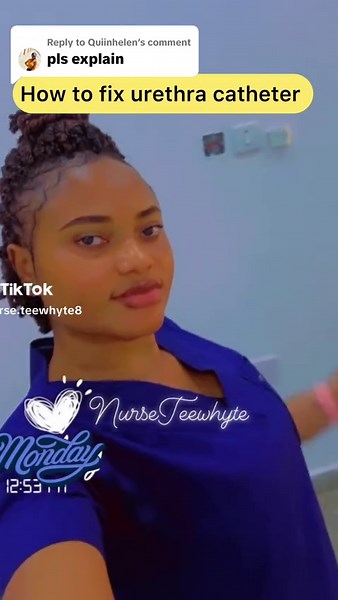 How to Successfully Pass a Retraction Catheter