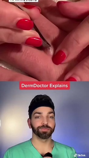 #dermdoctor #dermatologist #skincare #hairsplinter #barber Whaaat is that?! | Doctorly