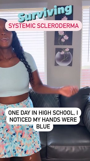 Understanding Systemic Scleroderma: Personal Insights