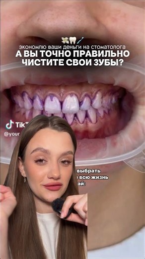 What toothpastes do you use?✨#beauty #teeth #care #teeth