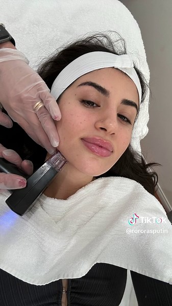 Morpheus 8: Kim Kardashian's Favorite Beauty Treatment