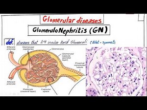RENAL PATHOLOGY 1ST LECTURE (GLOMERULAR DISEASES)
