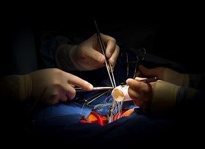 Minimally Invasive Aortic Valve Surgery