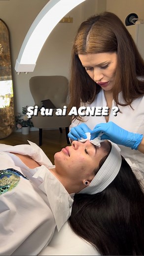 72K views · 1.5K reactions | “ Ce se întamplă cu fața ta? “ Tin minte...