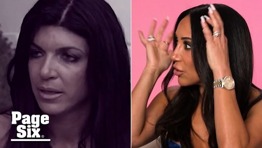 Melissa Gorga claims Teresa Giudice got her forehead surgically lengthened