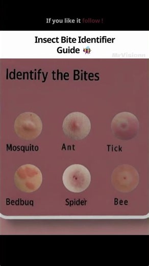 Who Bit You Find Out! 🐜