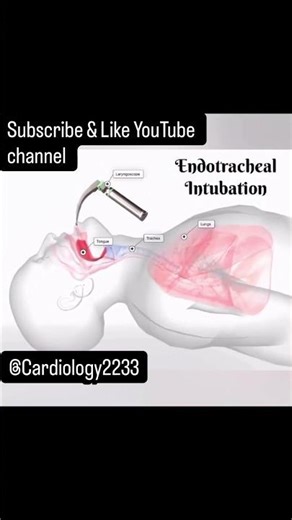 🫁 Endotracheal Intubation – कसे करतात? Like & Subscribe Channel