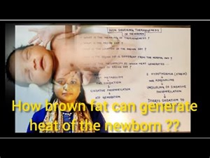 Thermal Regulation Of Newborn. Neonatal Hypothermia. Non Shivering Thermogenesis.