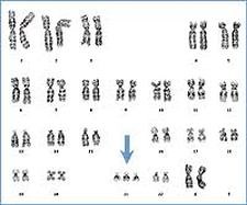 Soucres of Variation