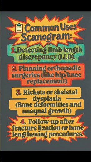 What is a Scanogram? 🦵📏 | Radiography Explained in 25 Sec.#ytshorts #youtubeshorts #radiology