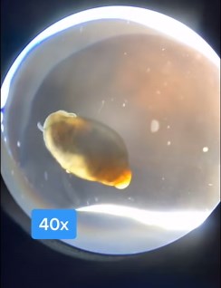 The hidden details of a baby snail revealed