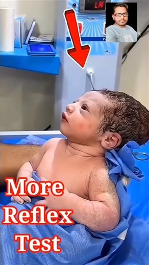 Important Baby Reflexes Doctors Check After Birth #More Newborn Baby Reflex Tests #(Startle Reflex)