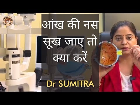 The Shocking Truth About Optic Atrophy Nobody Tells You आँख की नस का सूखना / कमजोर होना