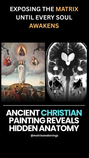 Matrix on Instagram: "Notice how, in the painting, the figure on the right hemisphere holds his hands together. This gesture symbolizes unification, reflecting how the right hemisphere of the brain perceives reality as a whole, holistic image. In contrast, the figure on the left hemisphere has his hands apart, symbolizing division. This mirrors the function of the left hemisphere, which takes the unified perception of the right and breaks it down into separate parts for analysis. For example: th