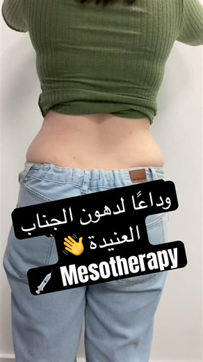 وداعًا لدهون الجناب العنيدة 👋💉 Mesotherapy
