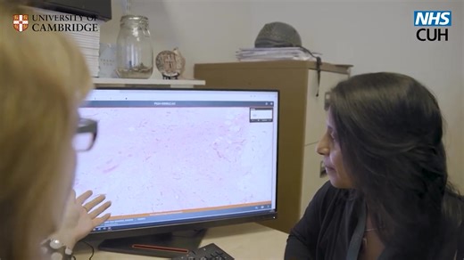 A new treatment approach significantly improves survival rates for patients with inherited BRCA1 and BRCA2 breast cancer genes, following a successful trial. Professor Jean Abraham led the Partner trial which demonstrated two innovations: the addition of a targeted cancer drug, olaparib, and chemotherapy pre-surgery, and the benefits of careful timing of when the treatments are given to patients. Jackie took part in the trial when diagnosed in February 2019 with a small but aggressive tumour. “S