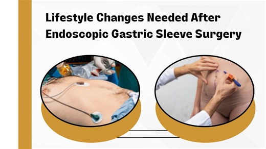 Advanced Procedure for Sustainable Weight Loss