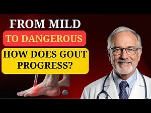 Gout Stages Explained: Symptoms, Progression & How to Prevent Dangerous Complications