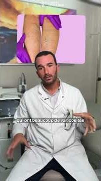 Varicose vein treatment