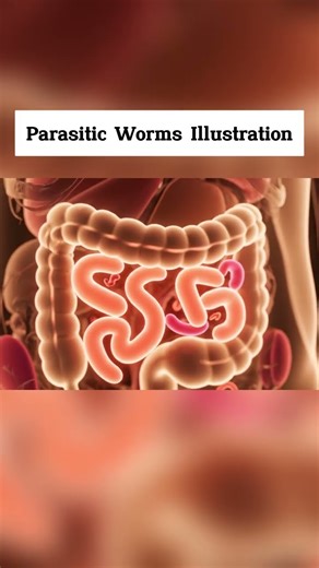 Parasitic Worms Illustration | Gut Health | Anatomy 3D Lab USA