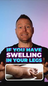 Here's what you could do if you have swelling in your legs or lymphedema | Dr. Livingood