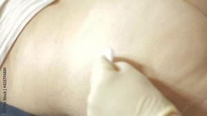 a medical professional gives an intramuscular injection to a patient, treats the disease with injections and vaccinations