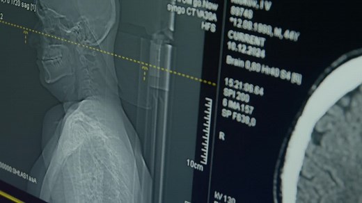 Deep brain stimulation trial explores new treatment for depression