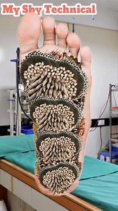 23K views · 67 reactions | Foot Asmr treatment for severe maggot infestation removal #asmr #animation part 1 | My Sby Technical | Facebook