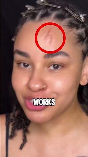 How To Make Fake Scars 🩸