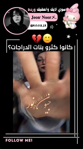 الوضع خرج عن السيطرةة🙂💔#جيش_التوليب#اكسبلور#bts#shorts#like#trend#song#fyp#fun#kpop#jk#ضحك#follow#fy