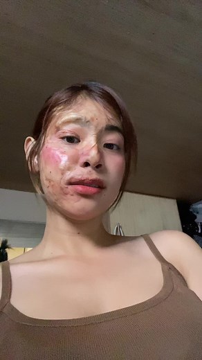 ehhhhh🥺🙂‍↕️ #lol #sfx