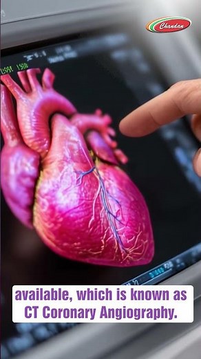 CT Coronary Angiography Explained | Clear Heart Diagnosis Without Surgery | Chandan Diagnostics