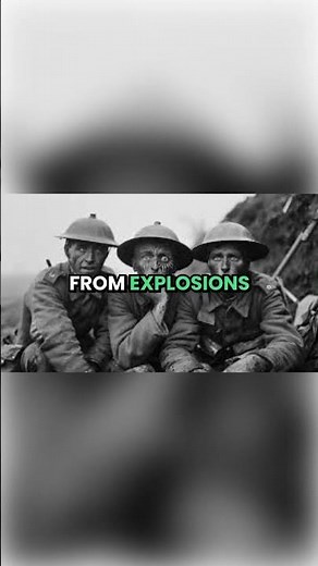 Shell Shock The Birth of War Trauma #history #facts #horrorstories #historydocumentary #ww2