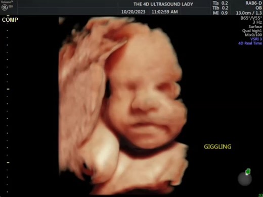 If this baby boy's giggle doesn't touch your heart, you are in a very dark place! #29weeks | The 4D Ultrasound Lady