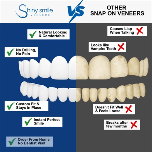Get the perfect smile, easily and without pain — no drills, no dentist visits! 😀 Save 20% on your snap-on veneers with code SOCIAL20 at checkout. Offer not valid on impression kits. | Shiny Smile Veneers