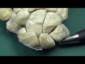 Triquetrum Anatomy and Osteology with Side Determination