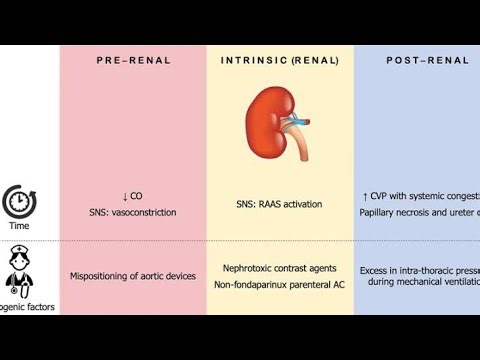 Pre Renal, Intrinsic Renal, Post Renal Classification of Acute kidney injury