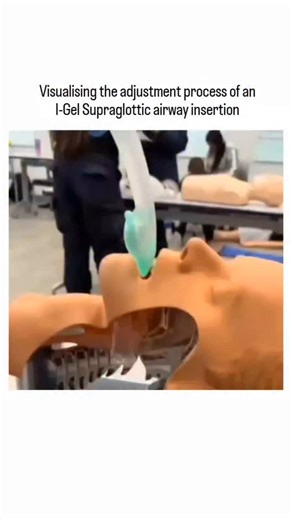 Science | This video provides a step-by-step visual demonstration of the adjustment process involved in I-Gel supraglottic airway insertion. Watch... | Instagram