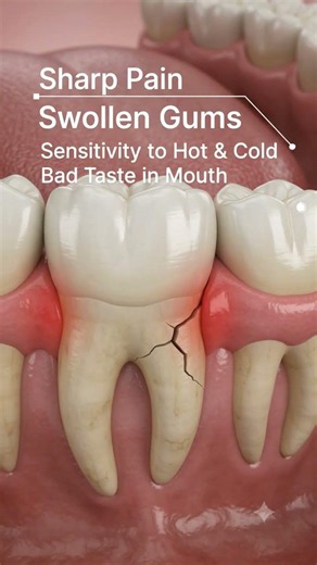 Broken Tooth Root Symptoms: Warning Signs You Should Never Ignore
